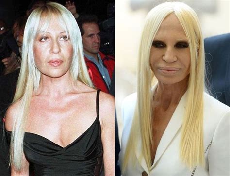 danotella versace|donatella versace before surgery.